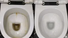 Puoli lasillista tätä liuosta ja WC-istuin kiiltää kuin hotellissa – siivoojan salaisuus