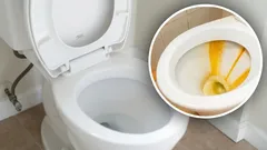 Vuosien lika katosi WC-pöntöstä: apuna kotitekoinen seos kolmesta ainesosasta
